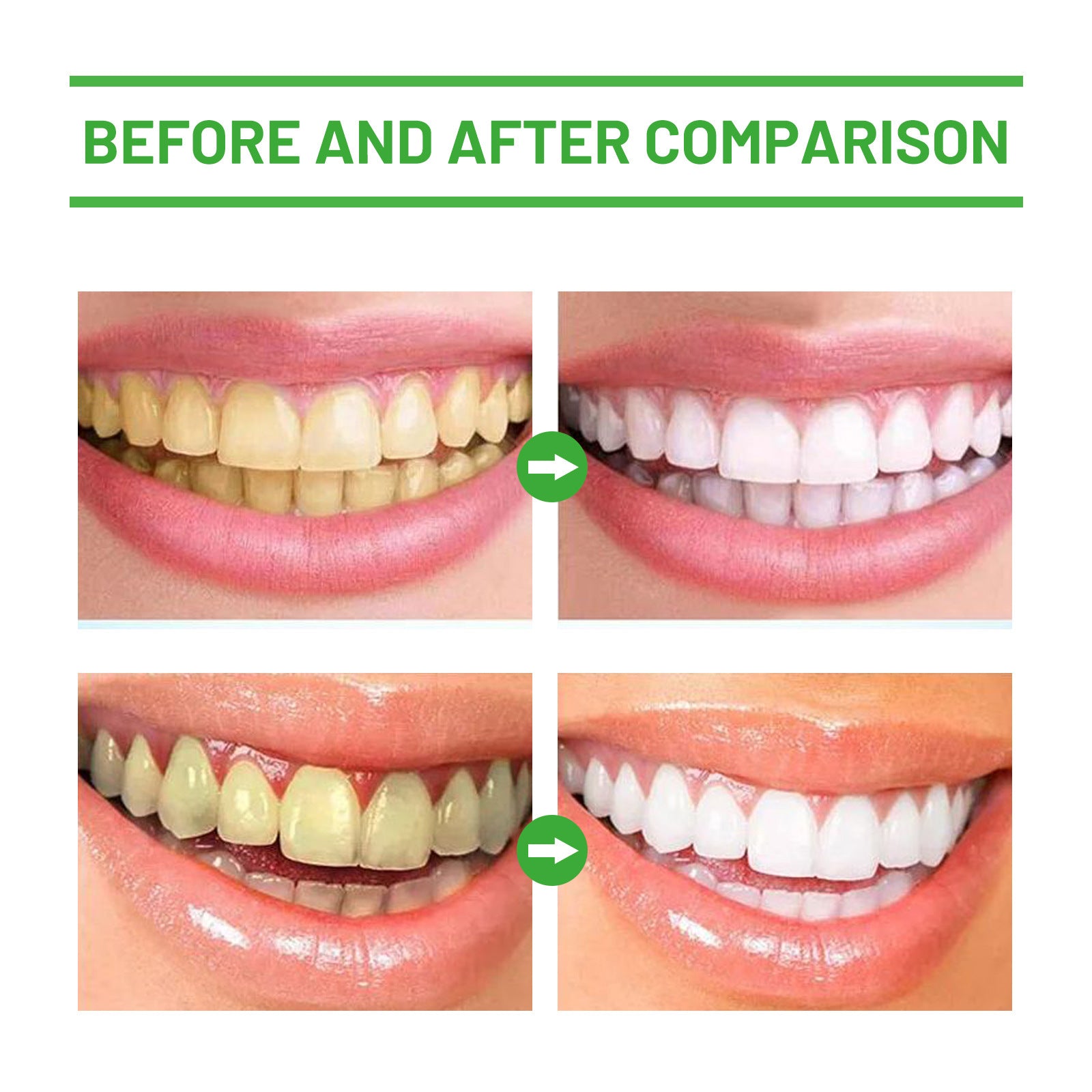 Natural Herbal Oral Mousse for Tartar Removal and Whitening