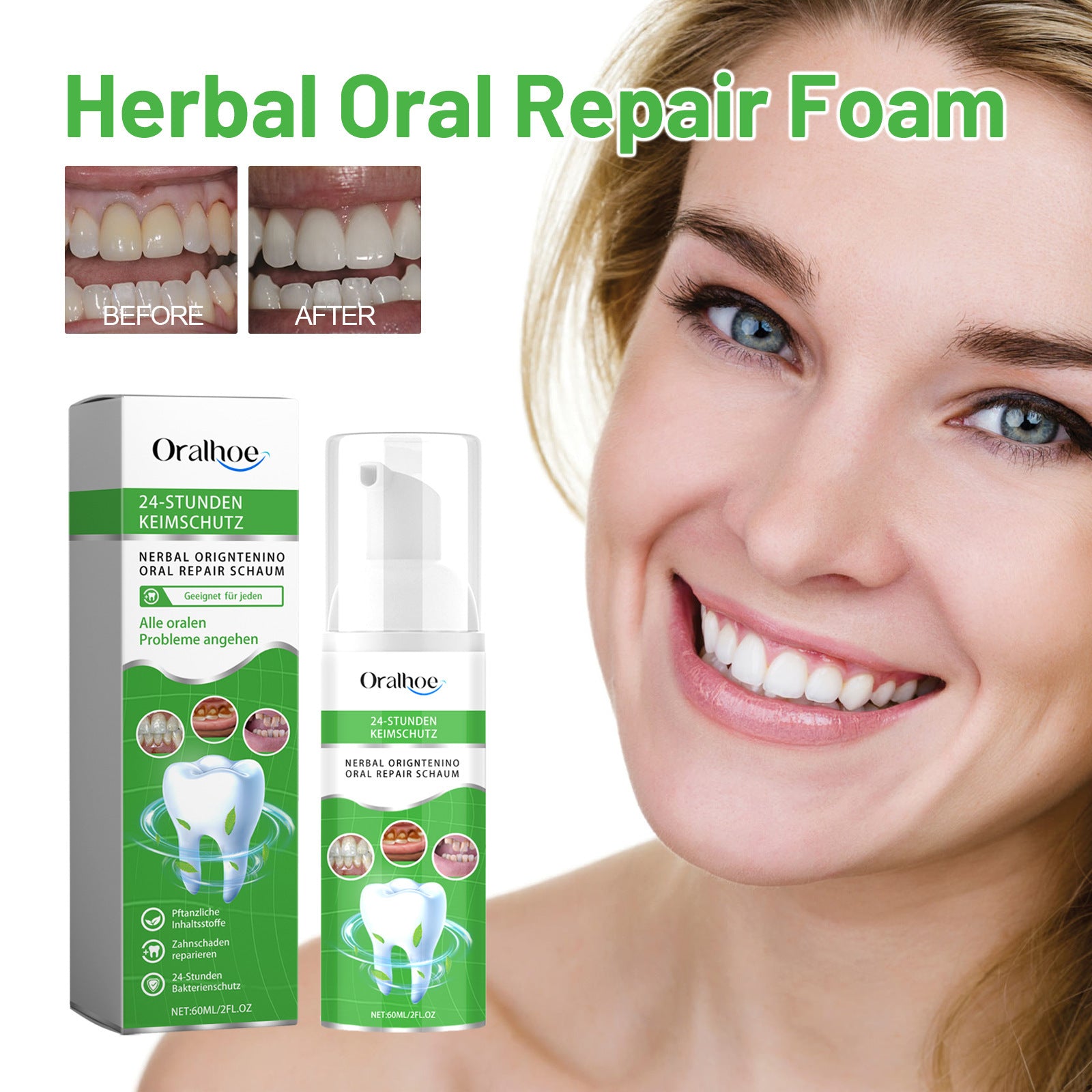 Natural Herbal Oral Mousse for Tartar Removal and Whitening